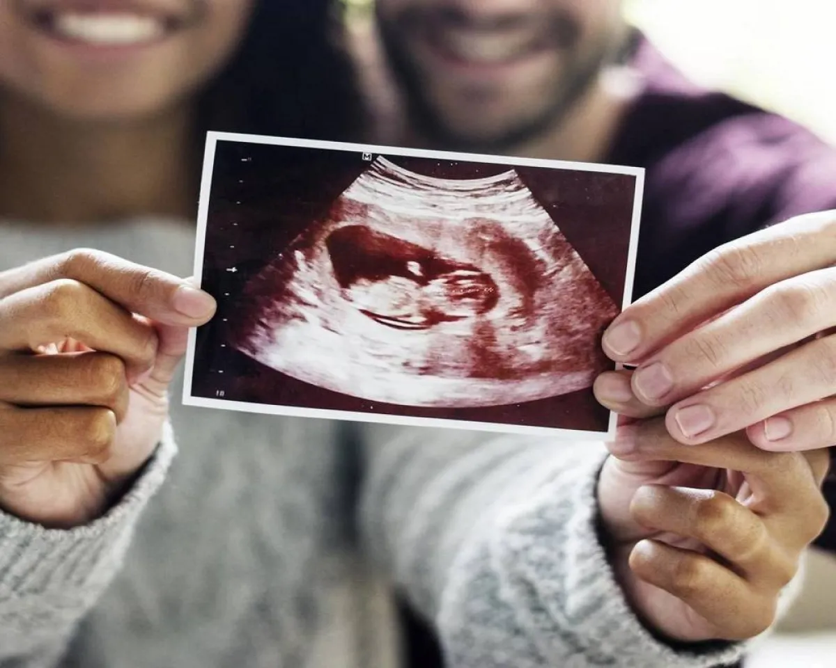 صورة لأشعة للتأكد من صحة الجنين