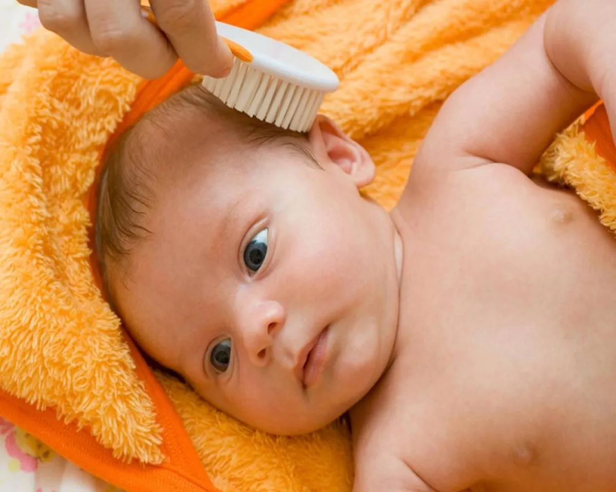 صورة لأم تحاول تقشير فروة رأس الطفل