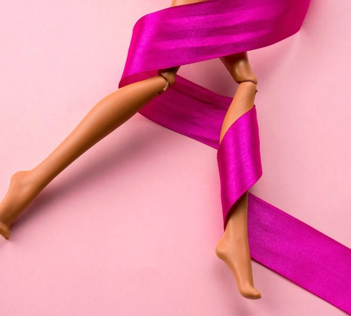 صورة تعبيرية عن دوالي الساقين