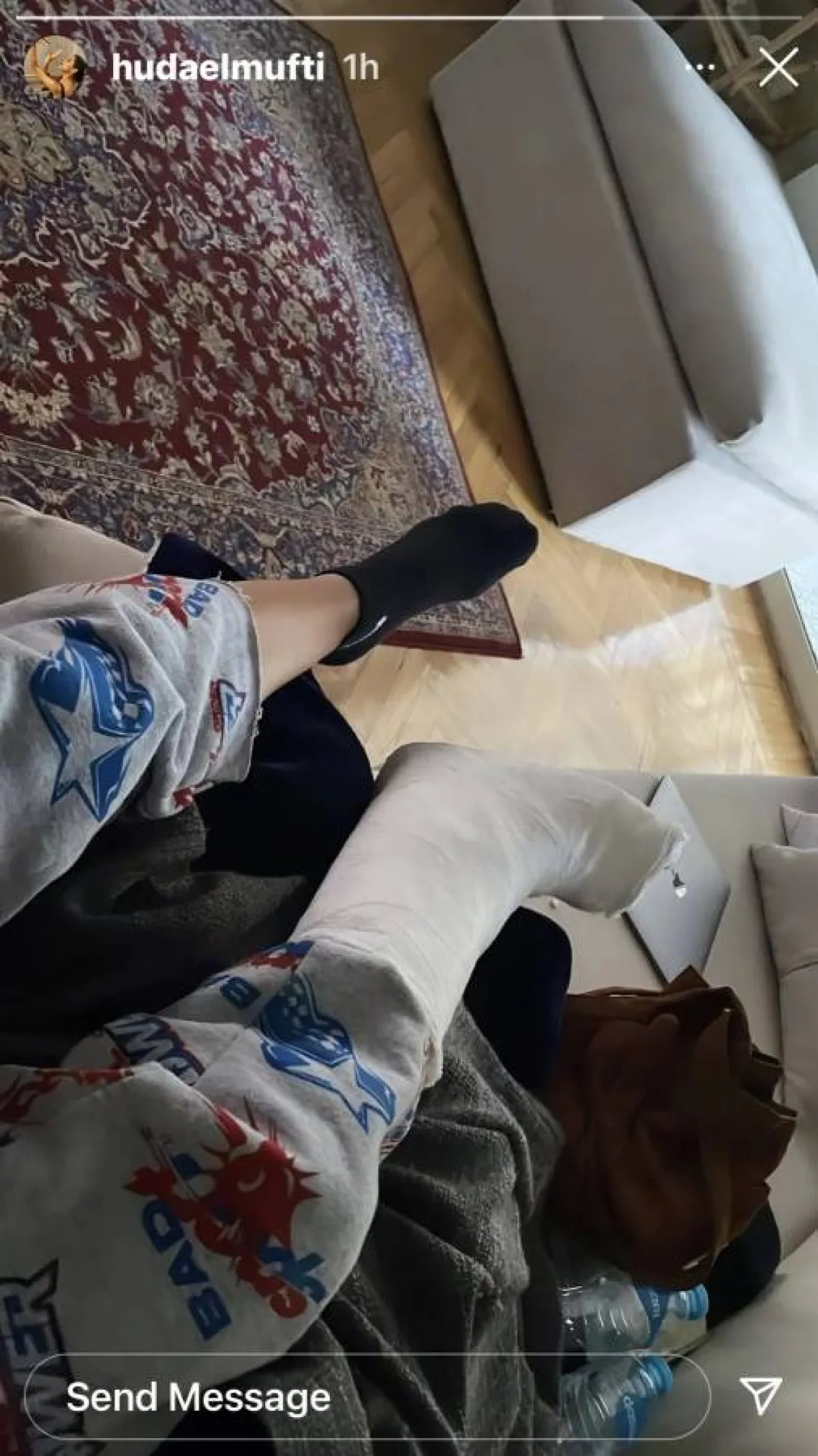 إصابة هدى المفتي بكسر في قدمها - الصورة من ستوري انستغرام هدى المفتي من حسابها الرسمي على انستغرام