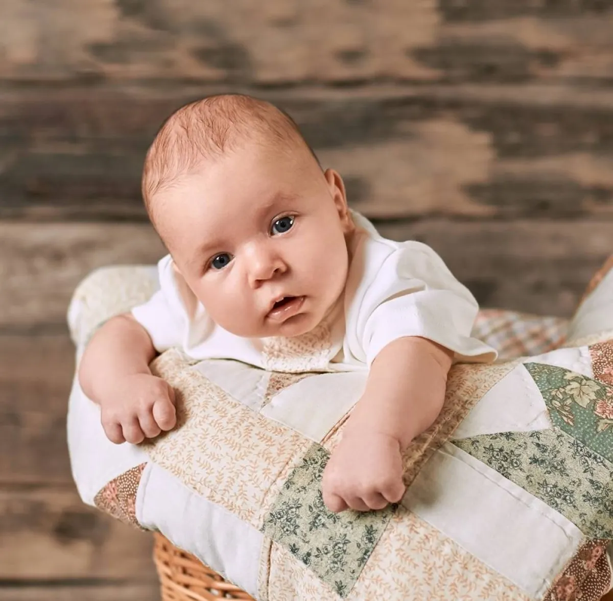 صورة لرضيع يعاني من رخاوة الرقبة