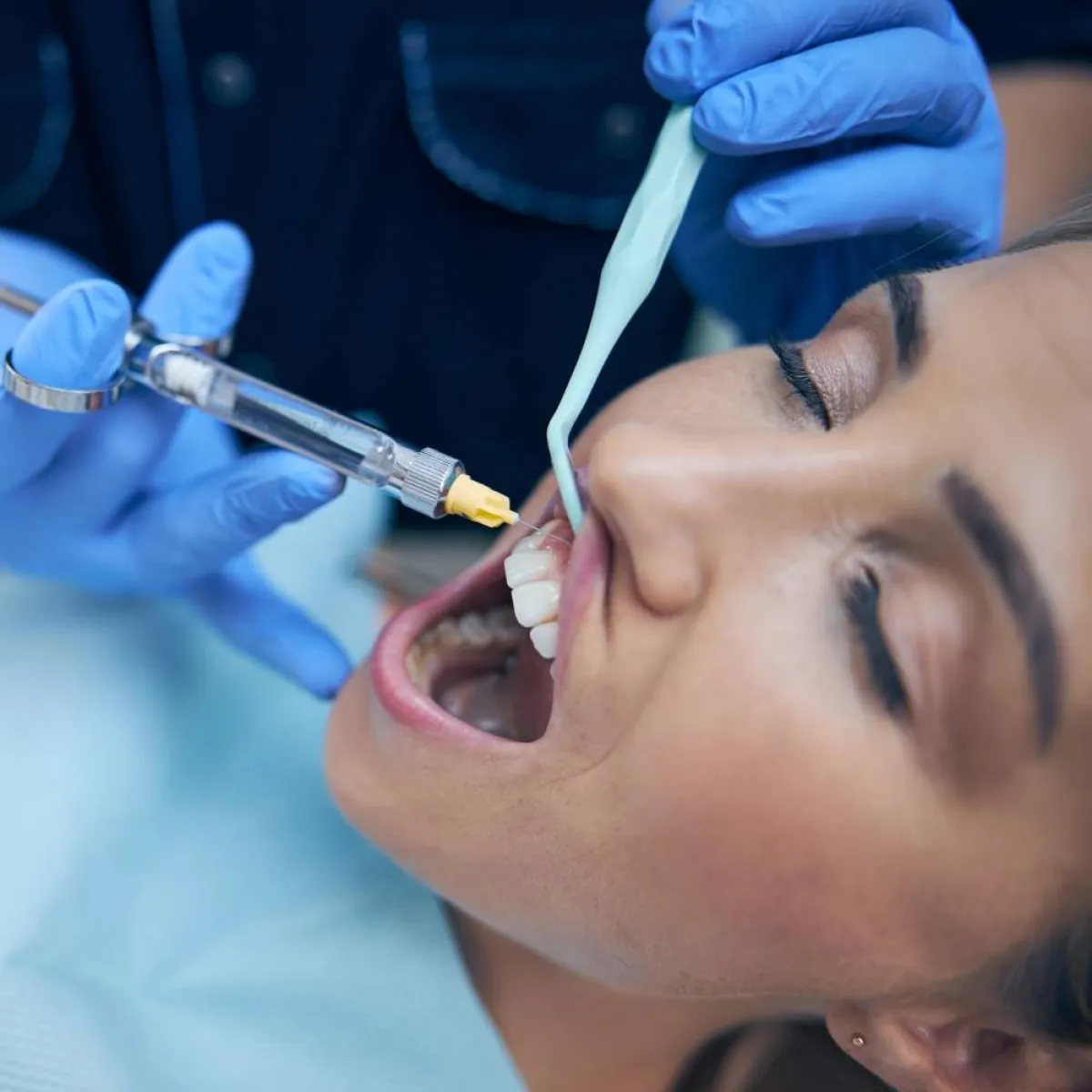 صورة لحامل تعالج أسنانها