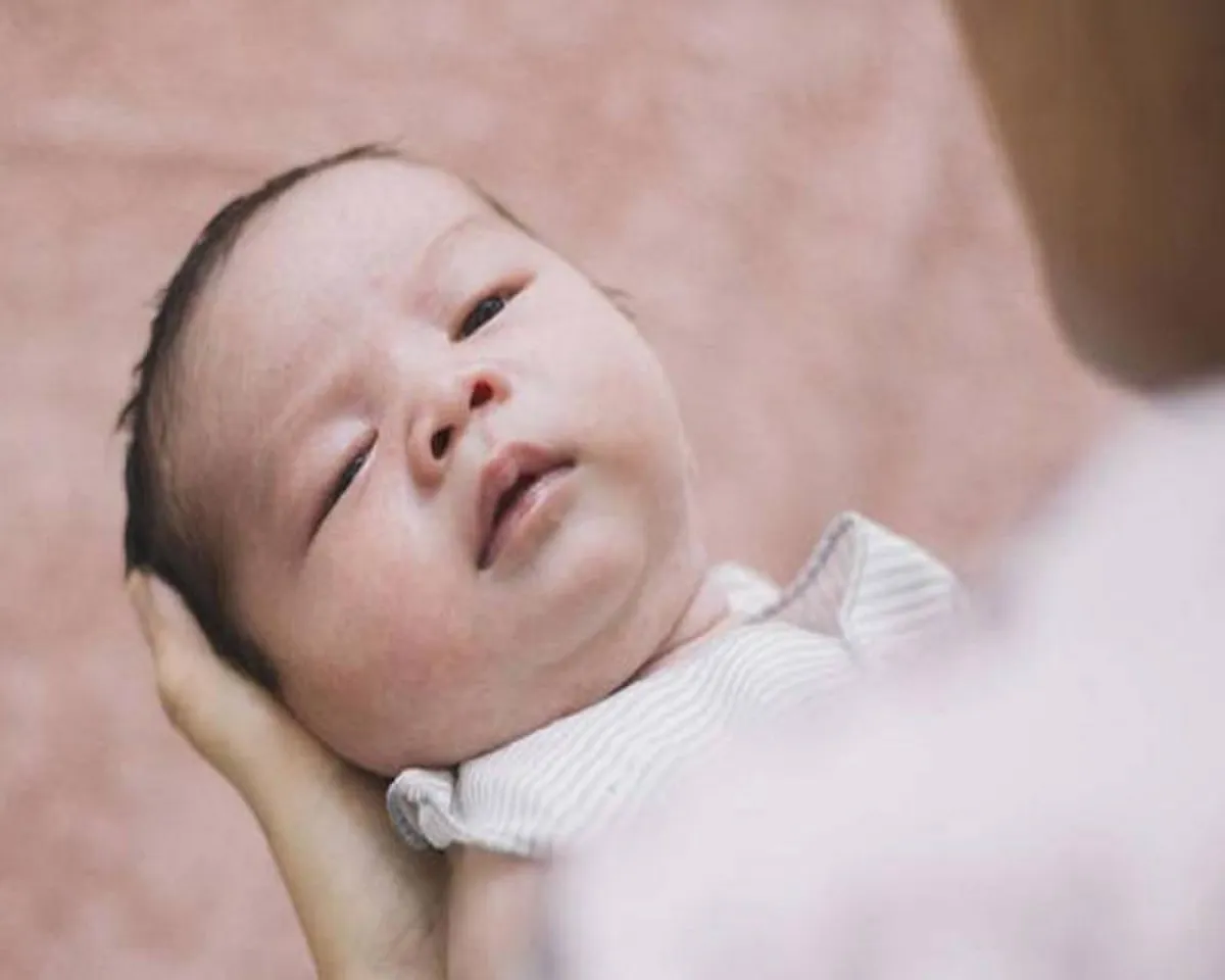 صورة لطفل يعاني من الحبوب البيضاء 