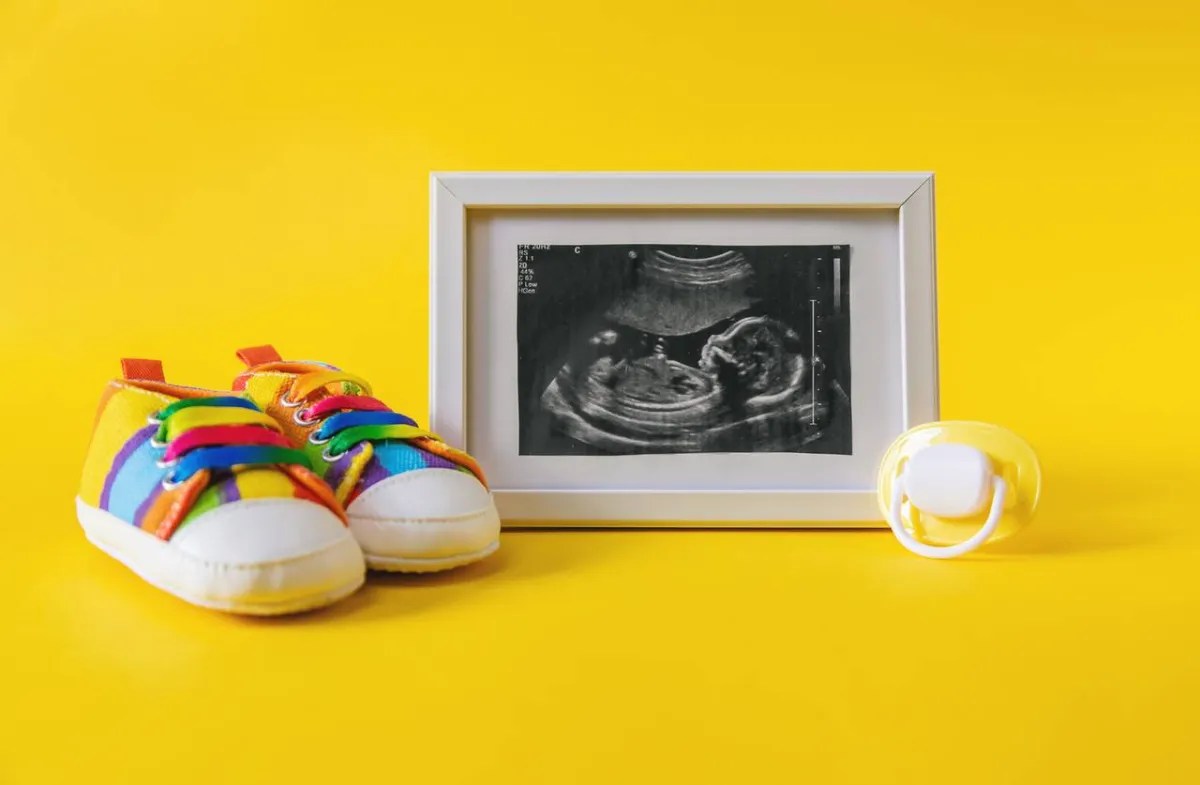 صورة تعبيرية عن متلازمة داون