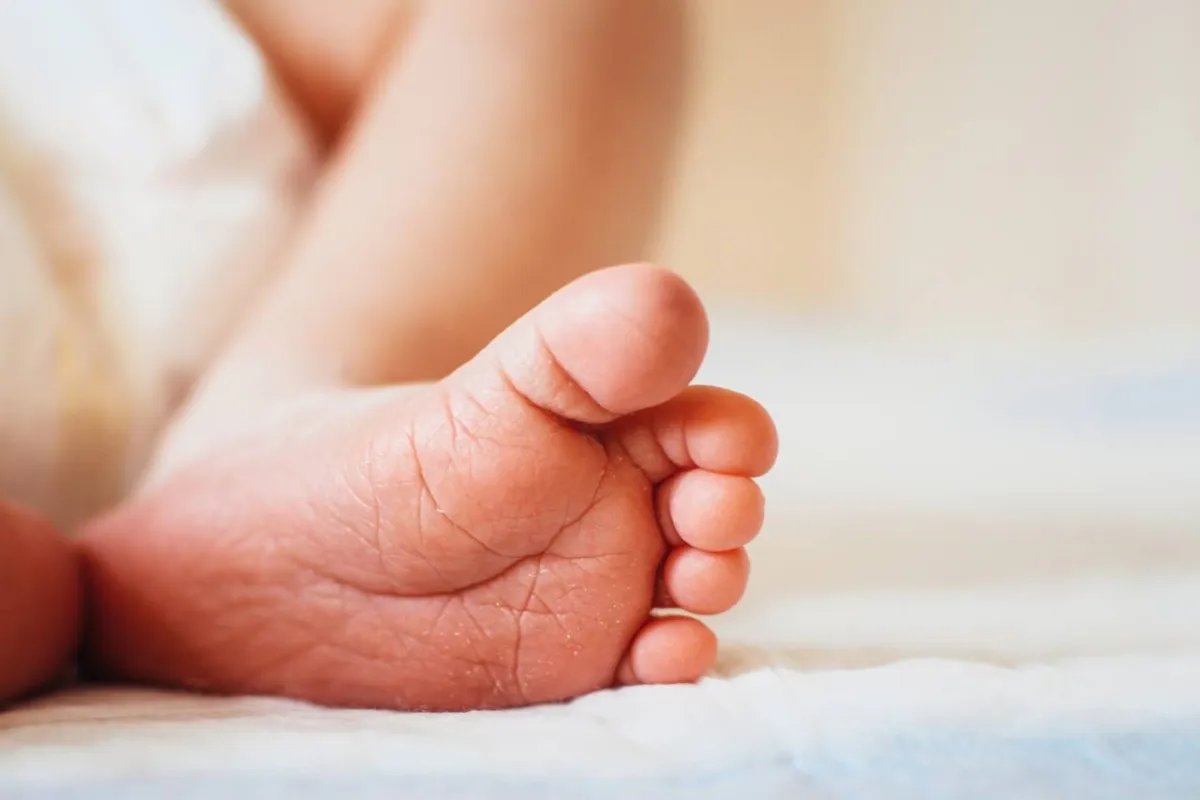 صورة لخشونة أطراف بشرة الرضيع