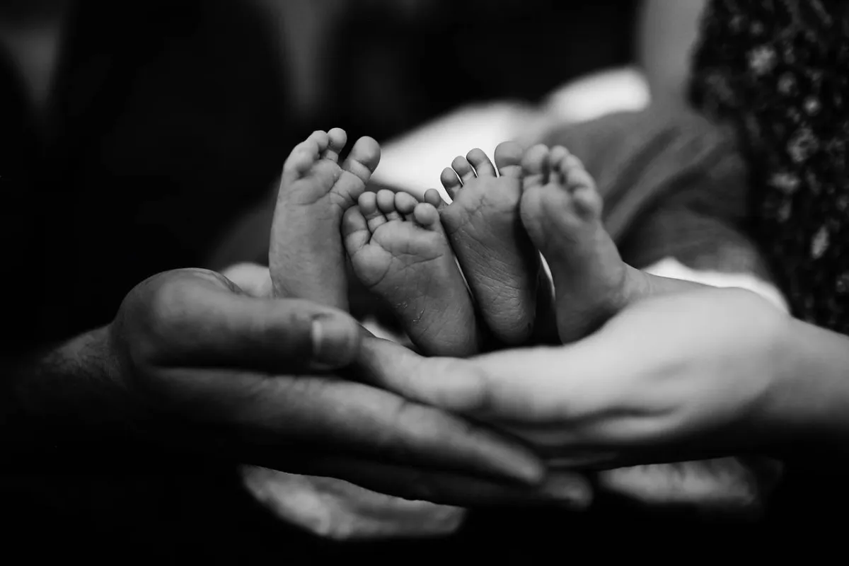 صورة لولادة توأم