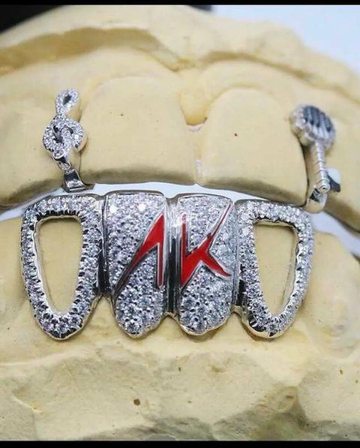 أليشيا كيز بمجوهرات خاصة بالأسنان بتصميم نوتة موسيقية ومفتاح-الصورة من حسابها على انستغرام