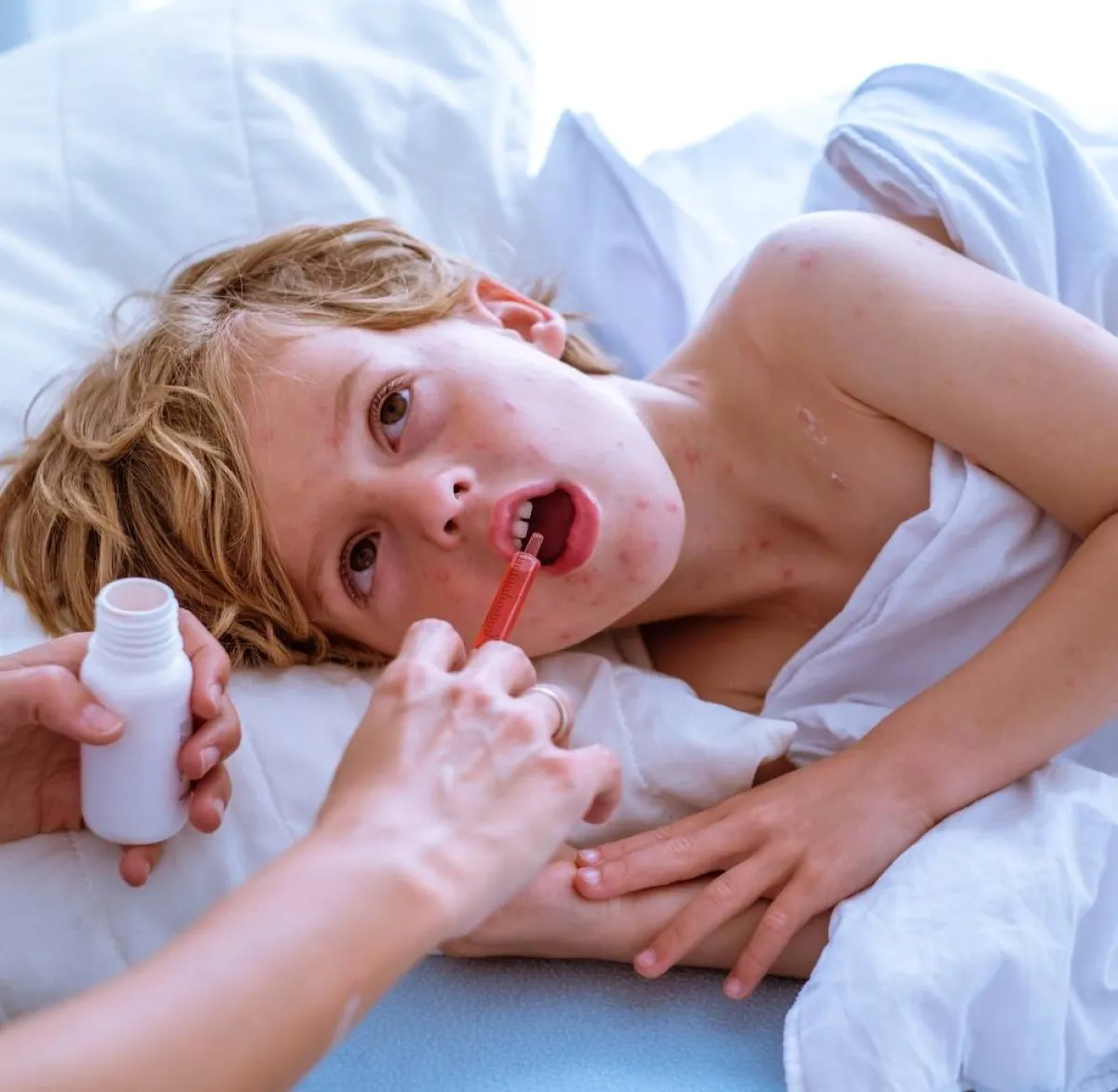 صورة لأم تعالج طفلها بخافض حرارة في المنزل من أعراض الهربس المزعجة