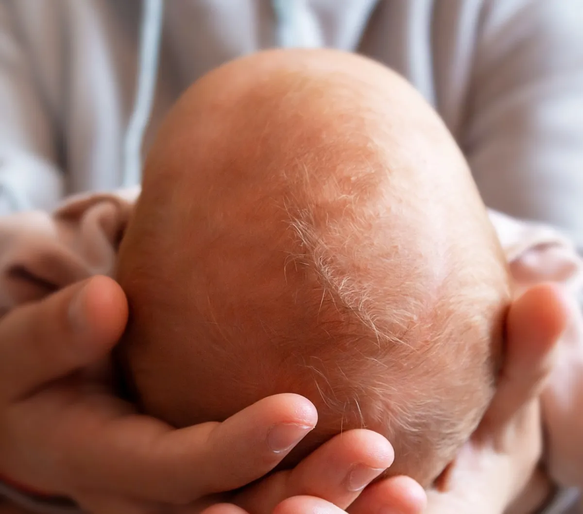 صورة لرأس الرضيع