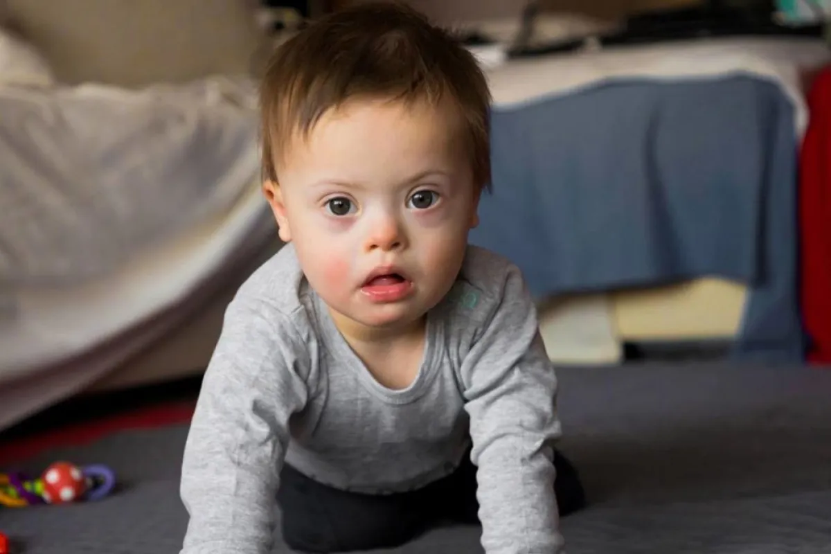 كل ما تريدين معرفته عن متلازمة داون