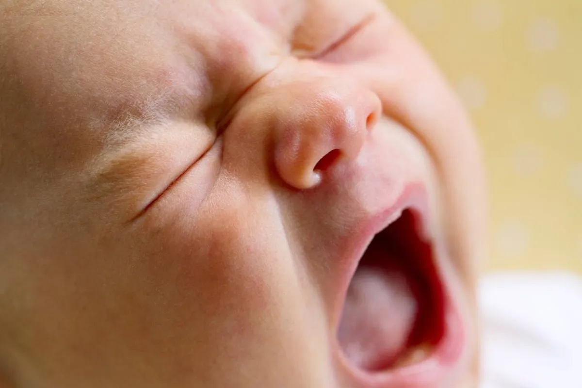 صورة لرضيع يتألم من ظهور السنة الأولى