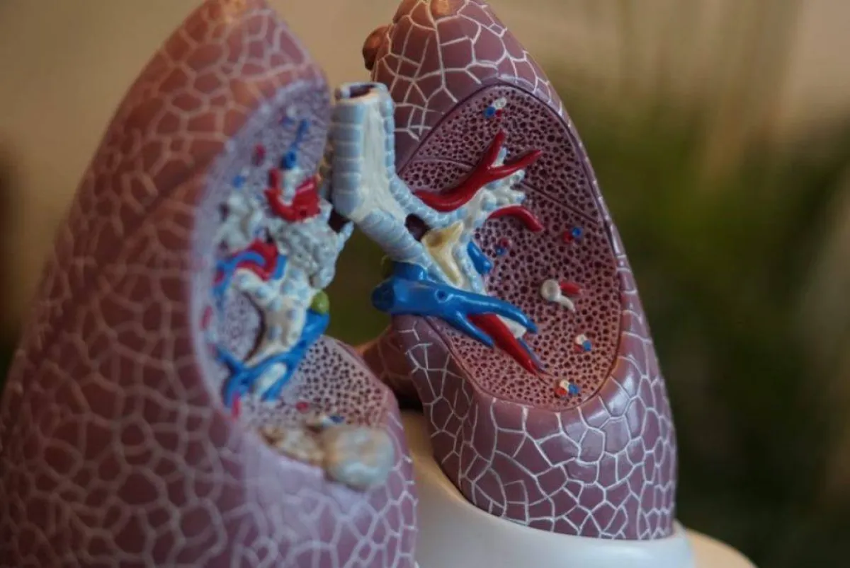 يمكن الخلط بين أعراض سرطان الرئة والتهاب الرئة