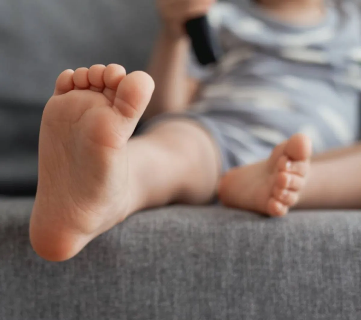 صورة لطفل يعاني من تقوس الساق بسبب نقص فيتامين د