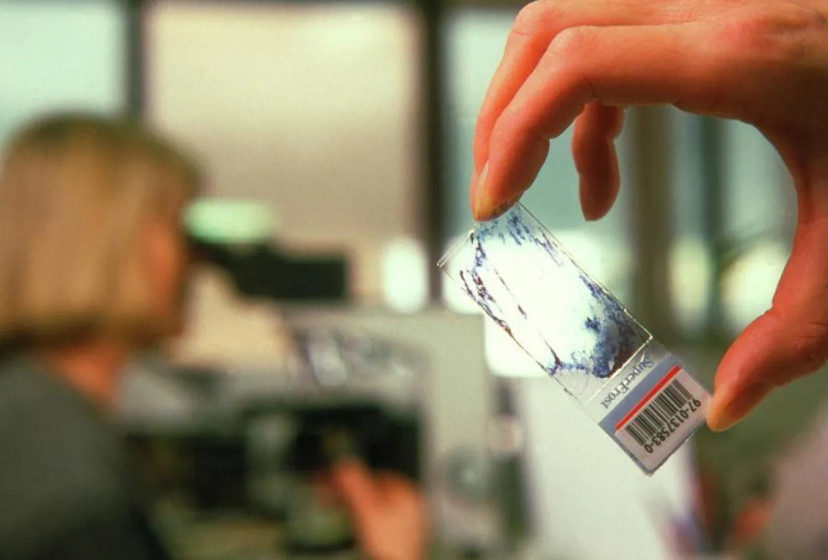 اختبار مسحة الرحم