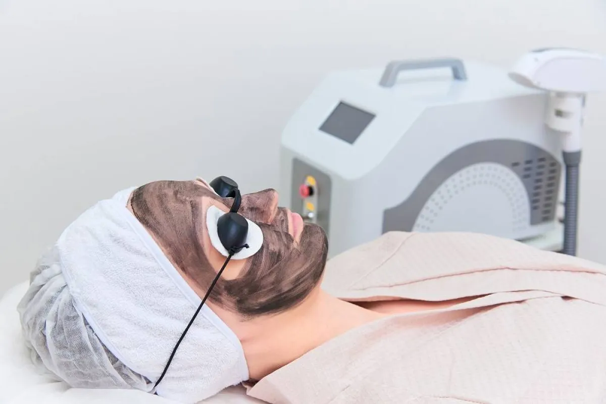 الليزر الكربوني