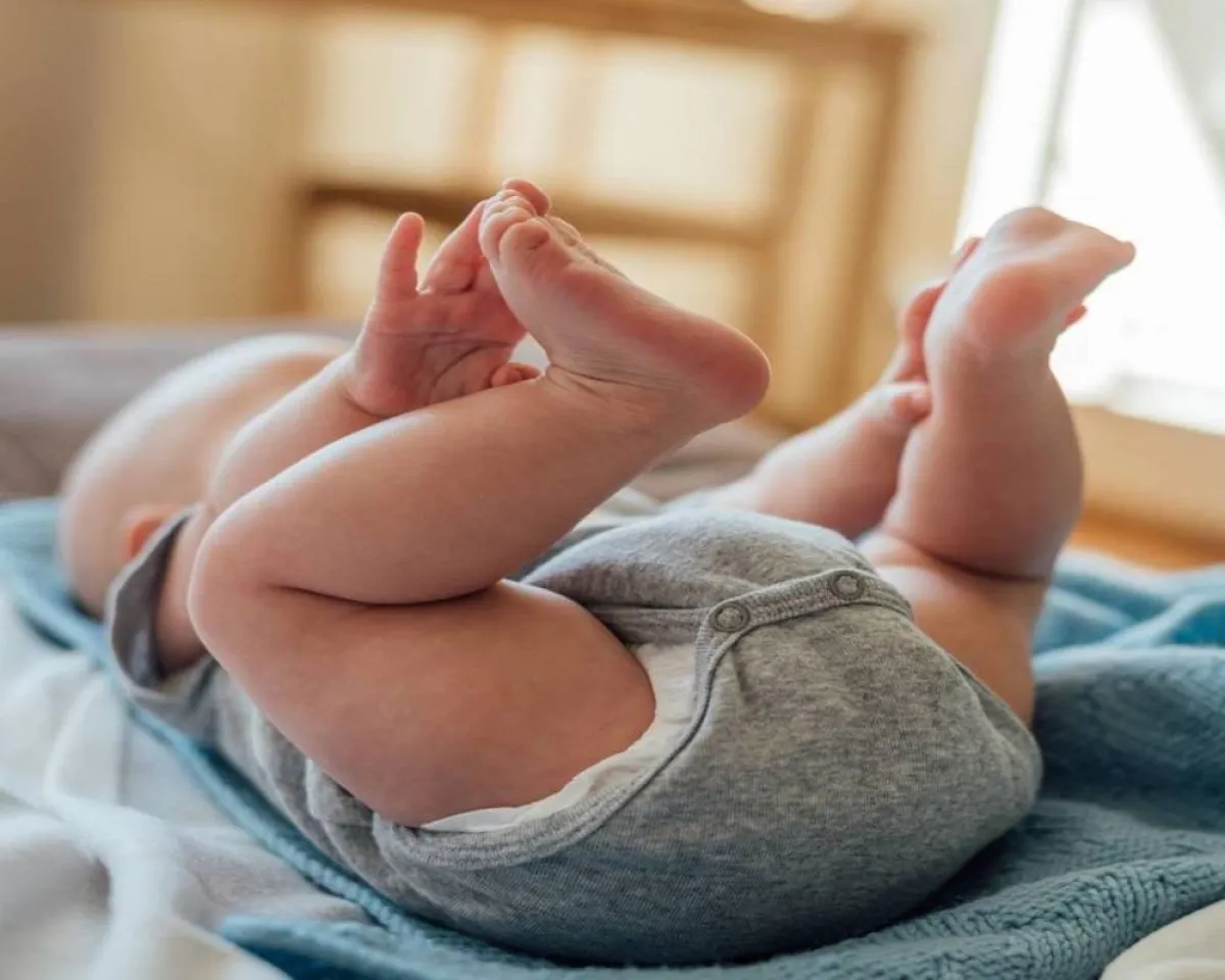 صورة لطفل رضيع مصاب بالكساح