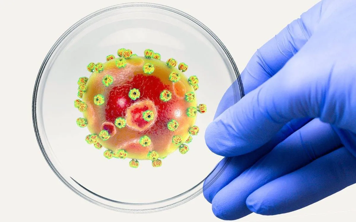 صورة لجزيئات حمى لاسا