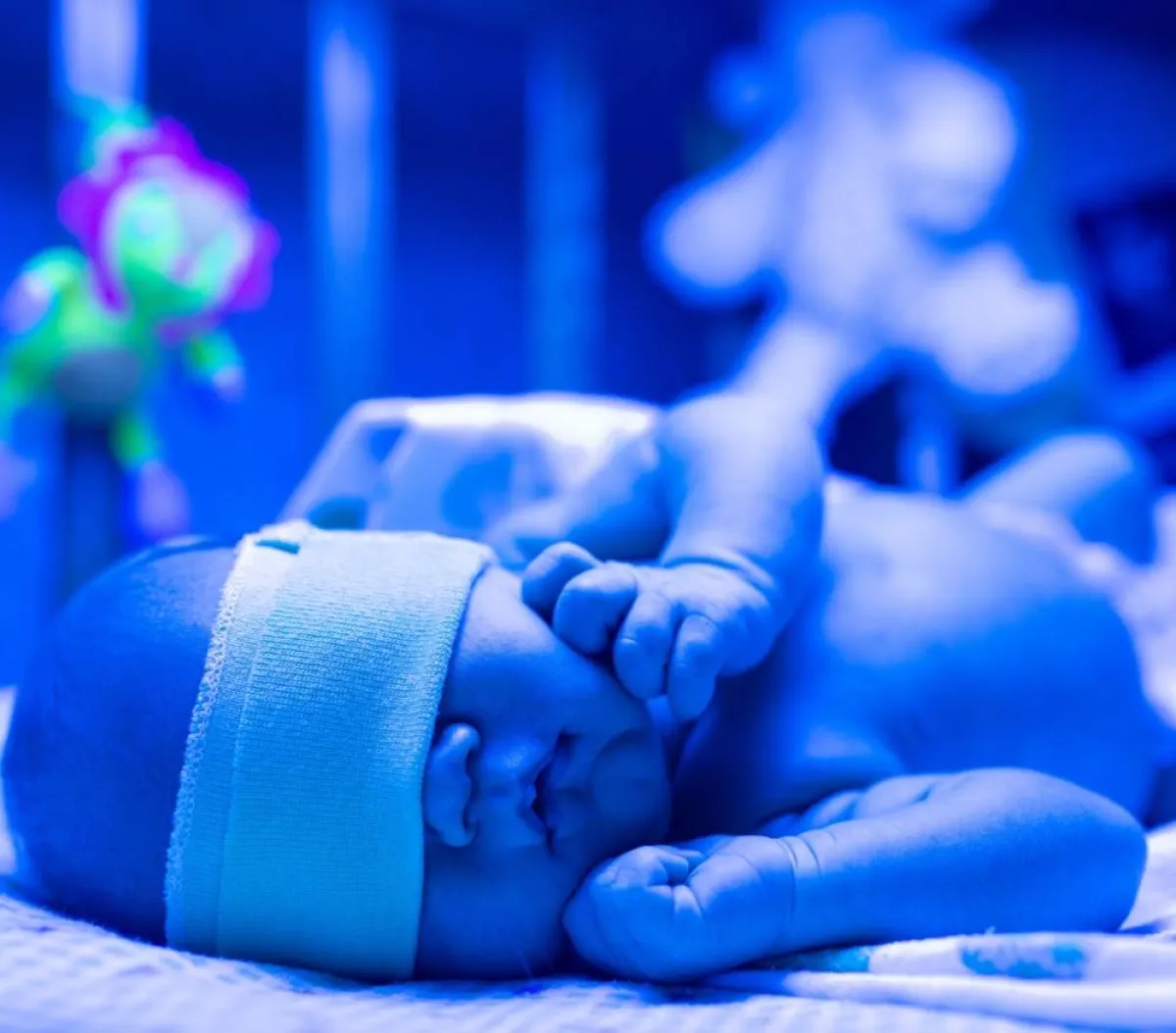 صورة لمولود خديج في الحضانة الصناعية