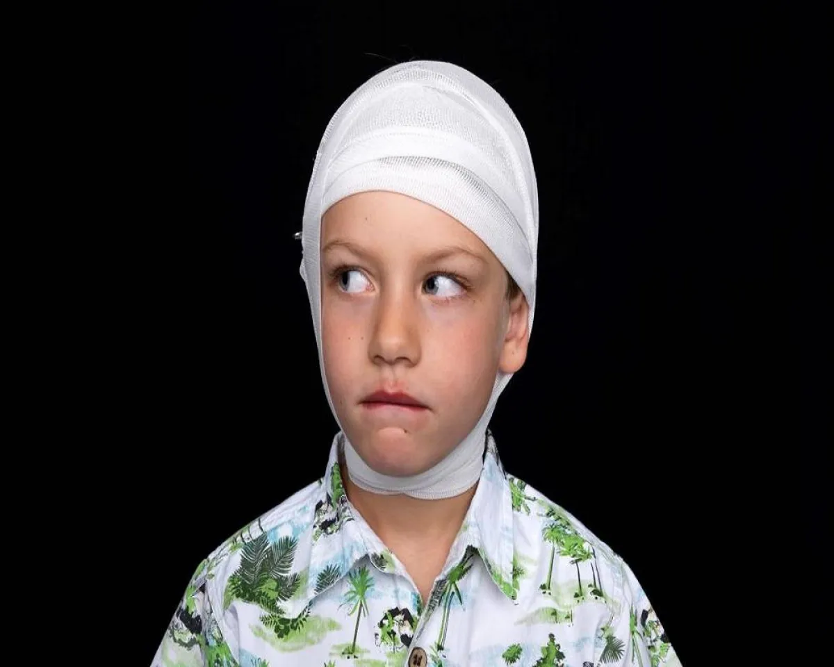 صورة لطفل يعاني من إصابة في الرأس