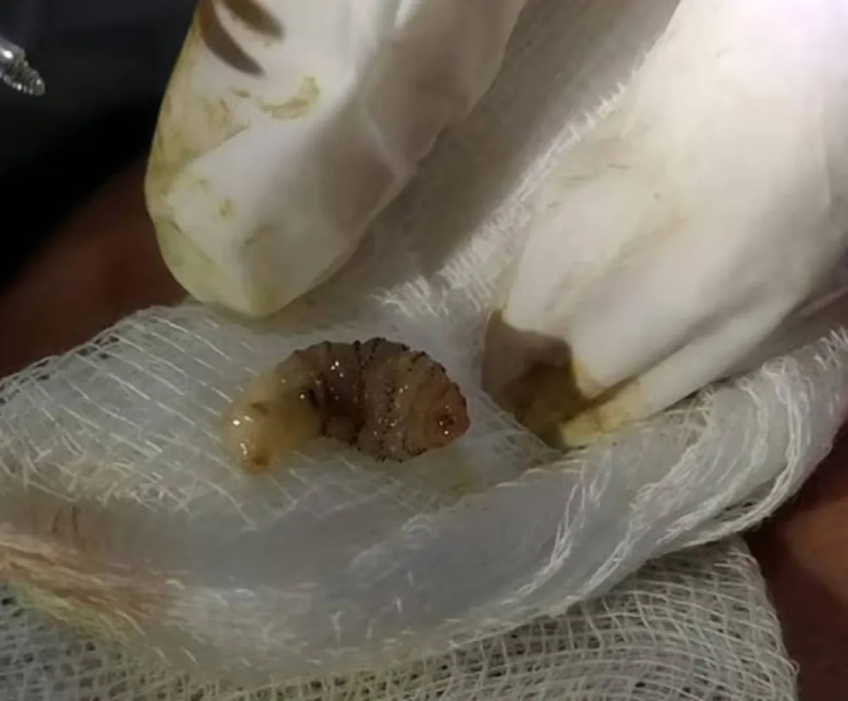 جراحة ناردة أطباء يزيلون 3 ذبابات حية من عين امرأة أمريكية