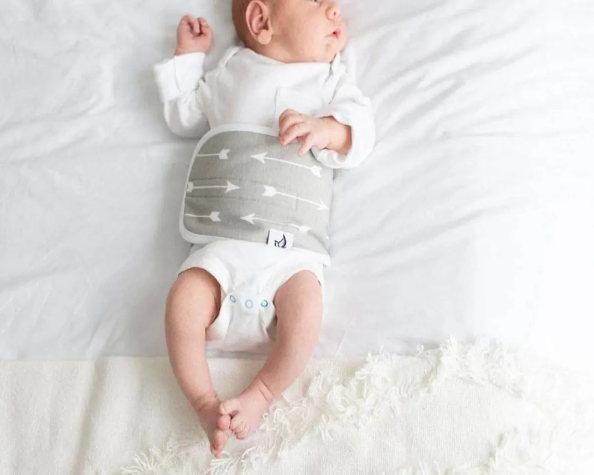 صورة لطفل صغير مصاب بمضاعات الفتق السري