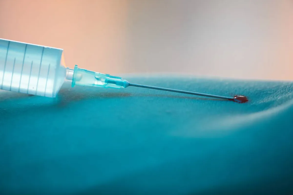 صورة لإبرة الإيبيدورال