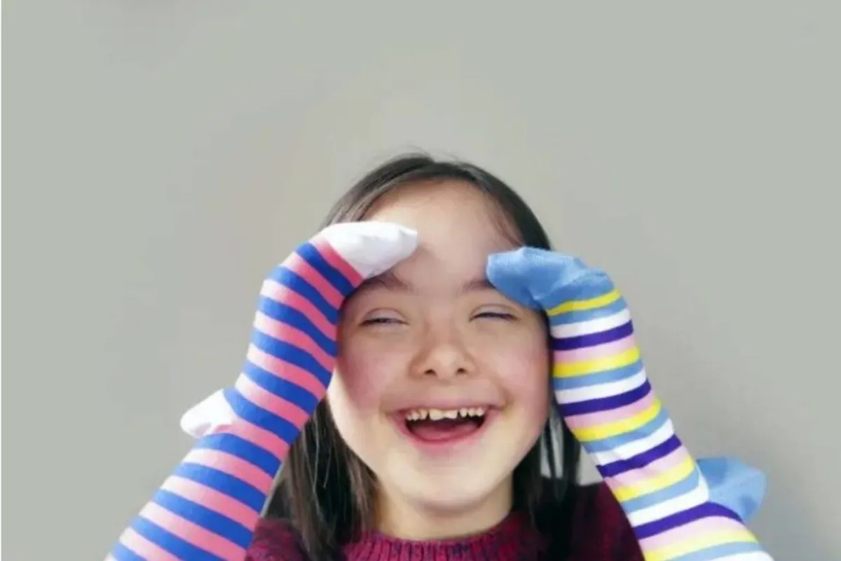 متلازمة داون 