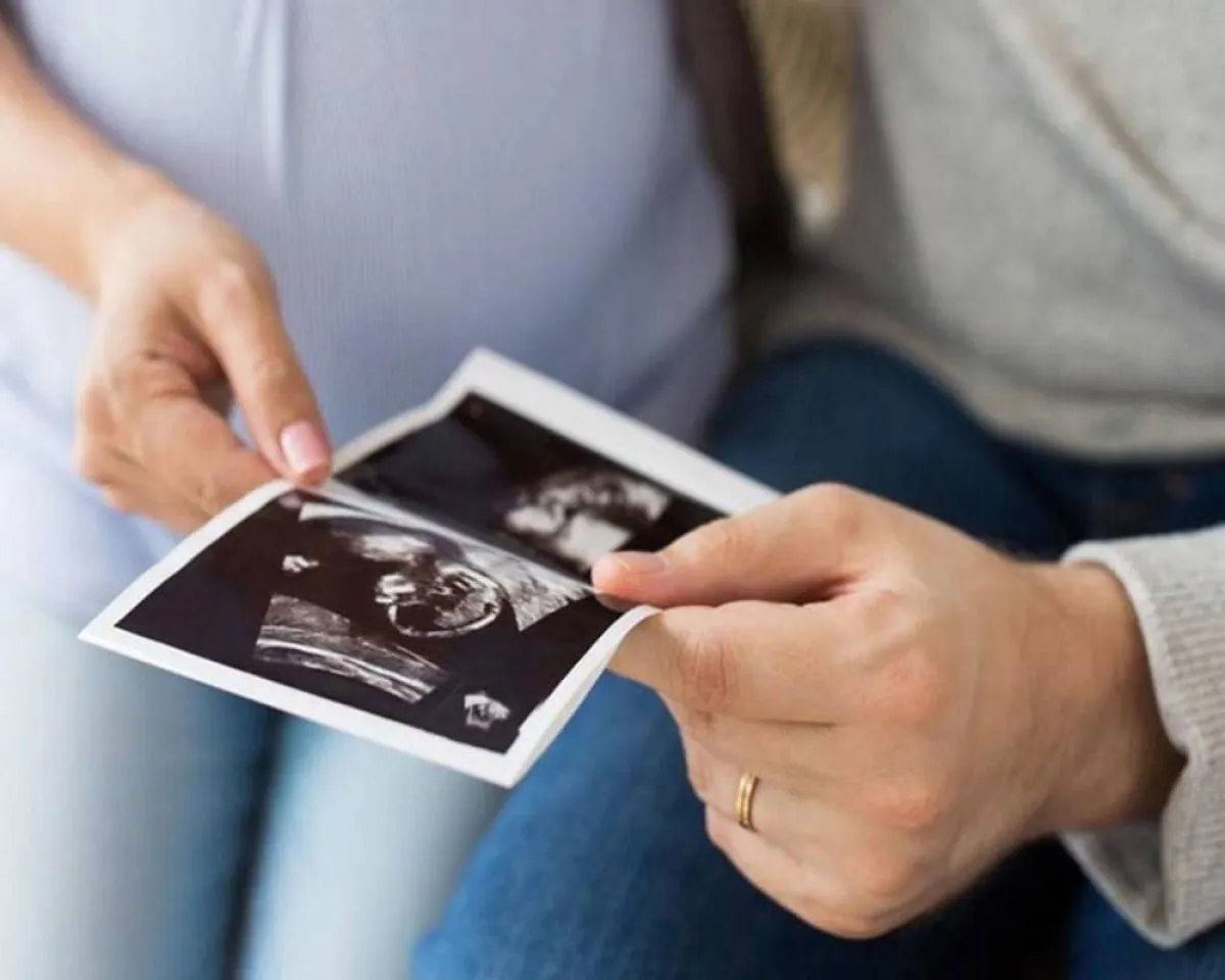 صورة لفحص بواسطة الموجات الصوتية