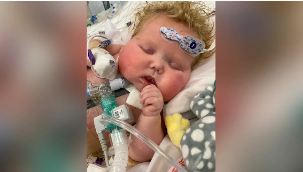 الطفل إيستون. الصورة من cnn