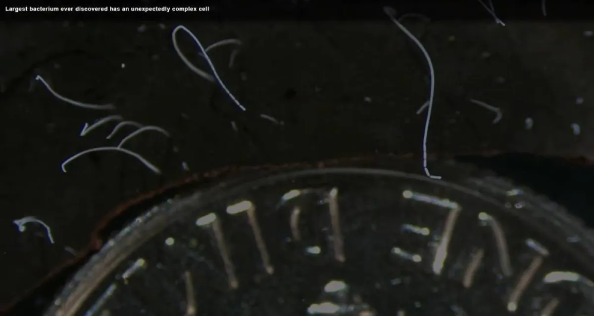 اكتشاف أكبر بكتيريا في العالم تُرى بالعين المجردة