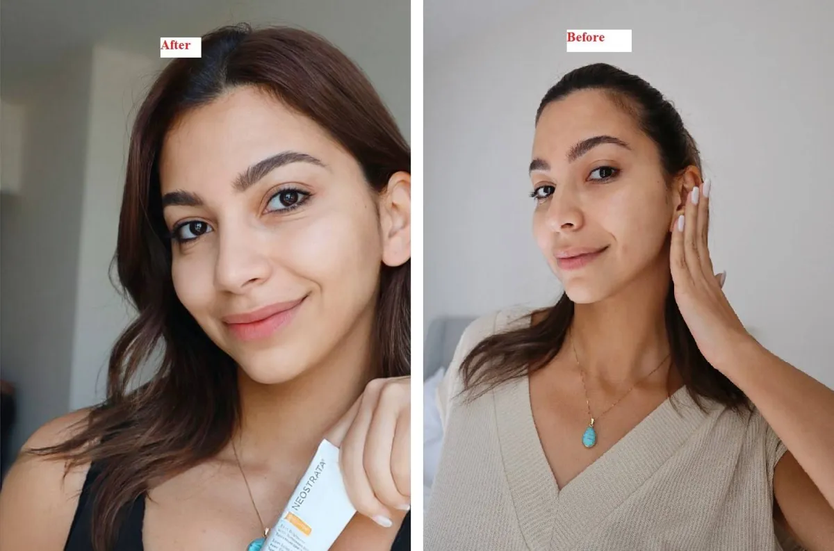 دانا قبل وبعد استخدام المنتجات 