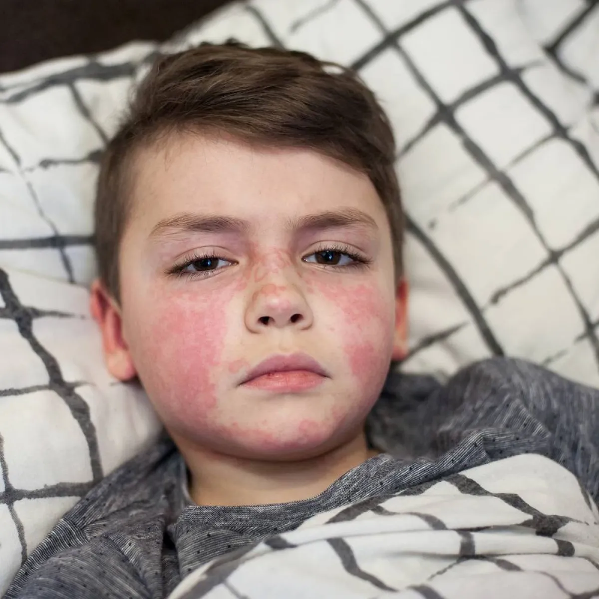 صورة لطفل مريض