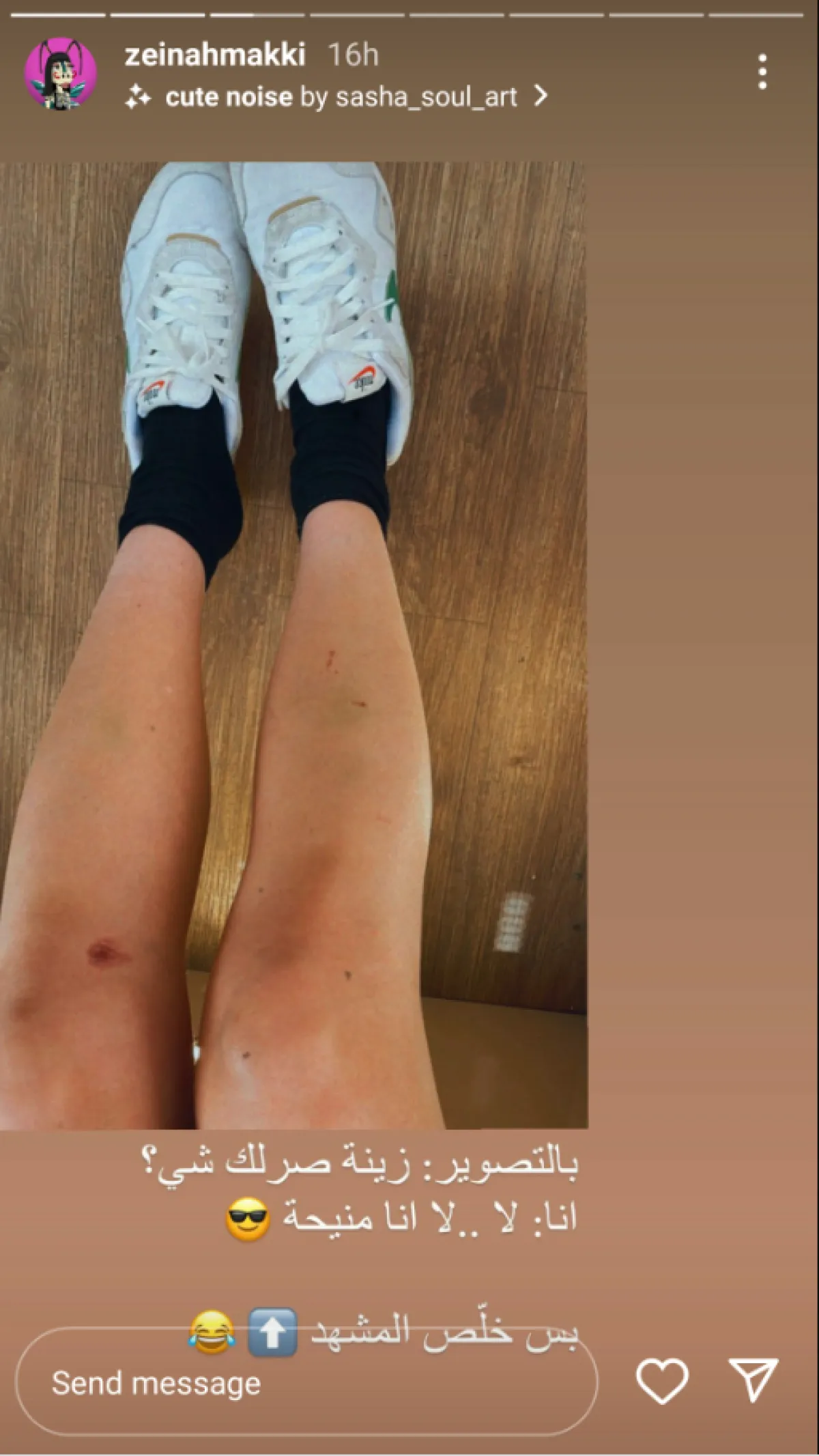 إصابة زينة مكي - الصورة من ستوري حسابها على انستغرام