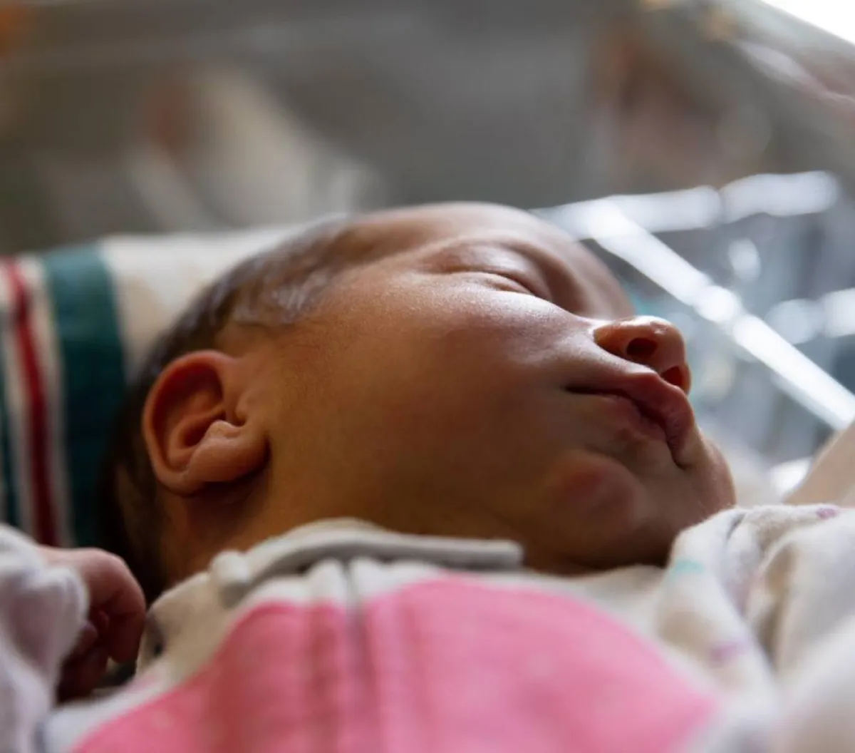 صورة لمولود يعاني من اليرقان