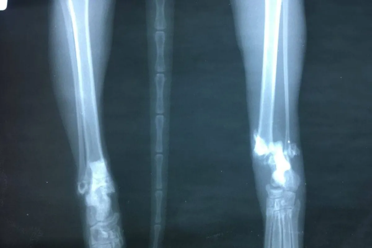  elements صورة تظهر أشعة هيكل عظمي حيواني مصدر الصورة  