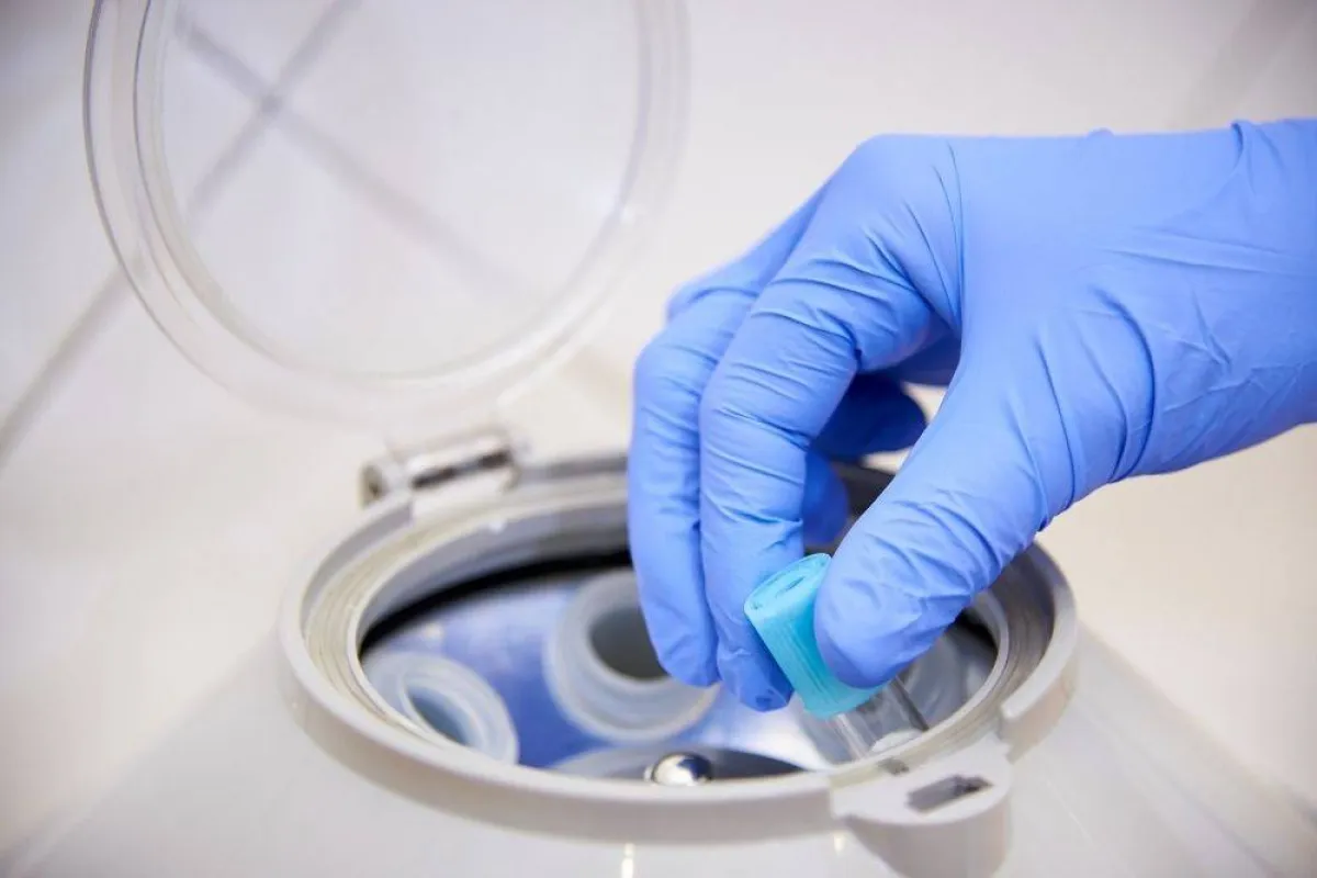 صورة تظهر التحاليل المختبرية مصدر الصورة elements