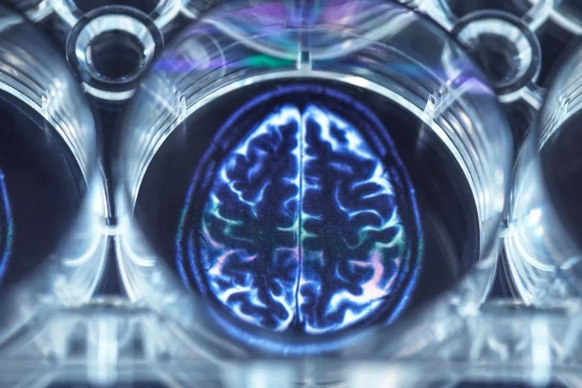 صورة تظهر الدماغ الطبيعي مصدر الصورة elements