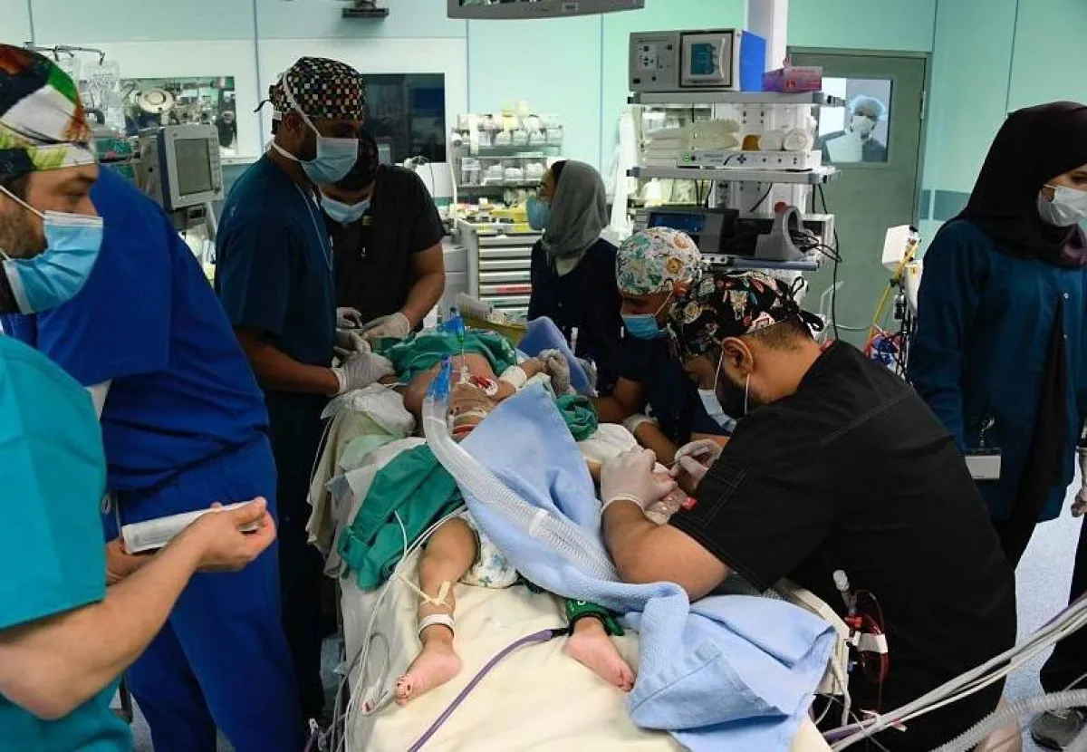 الفريق الطبي والتوأم. الصورة من "واس"