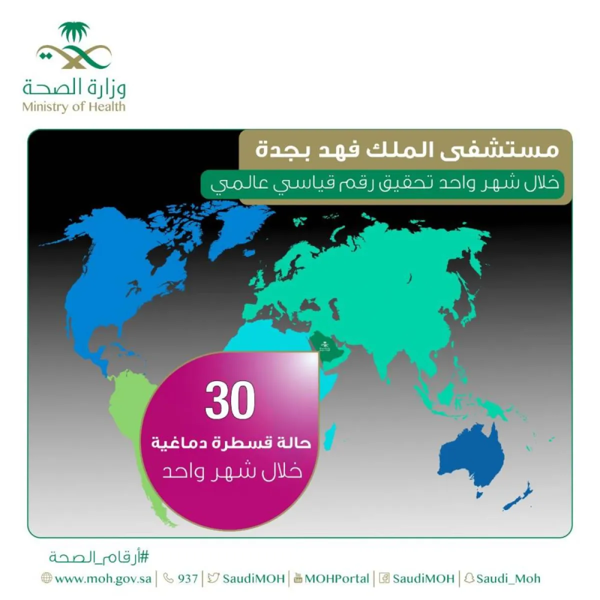 إجراء 30 حالة قسطرة دماغية بمستشفى الملك فهد بجدة خلال شهر واحد فقط و تحقيق رقم قياسي عالمي