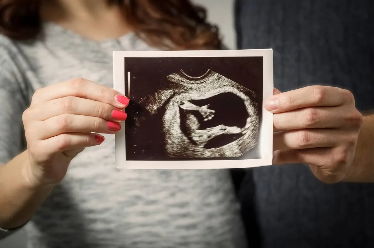 صورة ألتراساوند