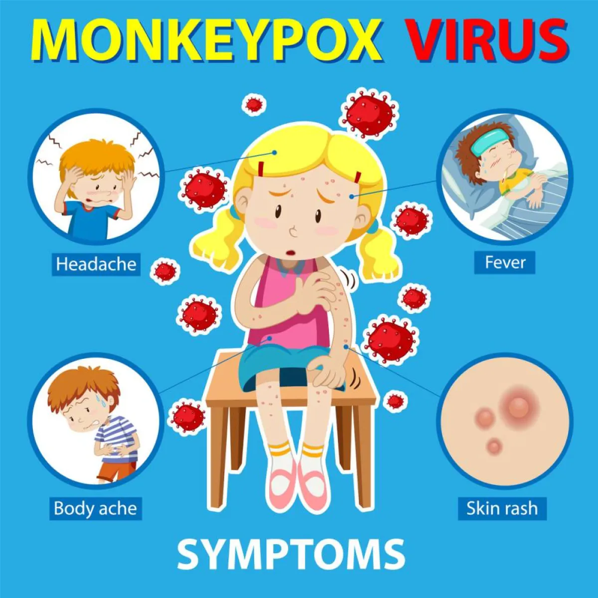 صزرة لطفلة مصابو بجدري القرود