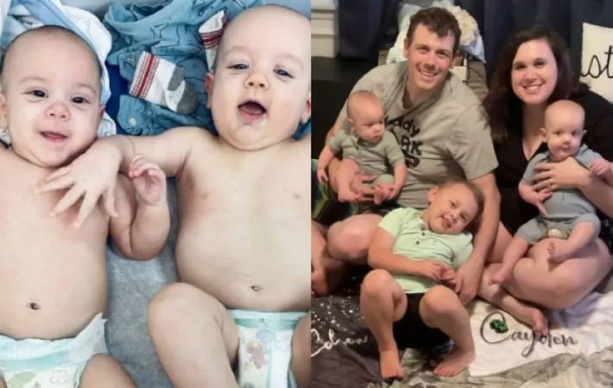 التوأمان المعجزة