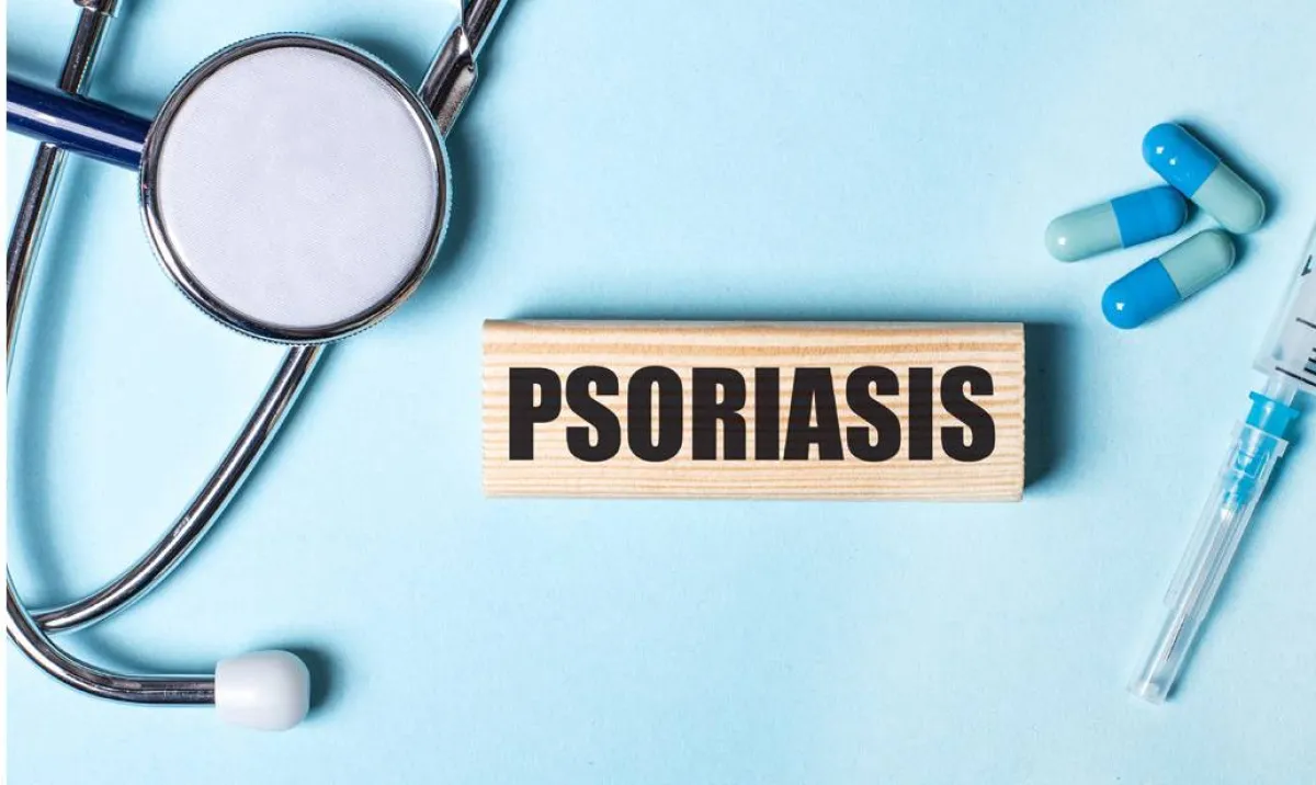 مفاهيم خاطئة تعزل المصاب عن العالم الصدفية..مرض جلدي لا يُعدي ويمكن علاجه 