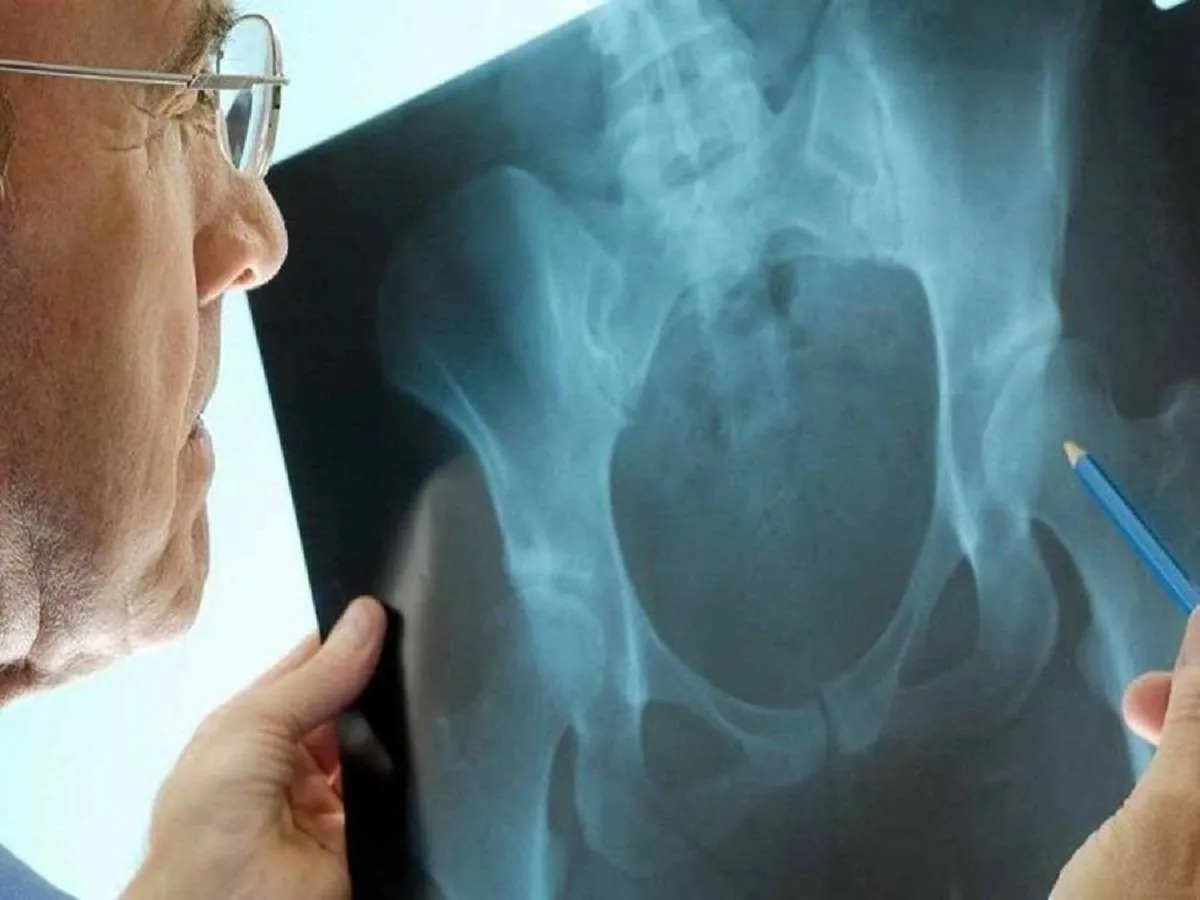 صورة لأشعة تشخيصية لعظام طفل