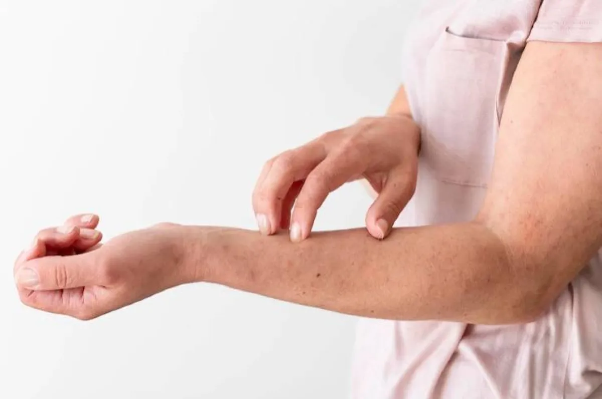 الالتهابات الفطرية والبكتيرية تسبب طفحًا جلديًا مما يؤدي إلى الشعور بالحكة الشديدة