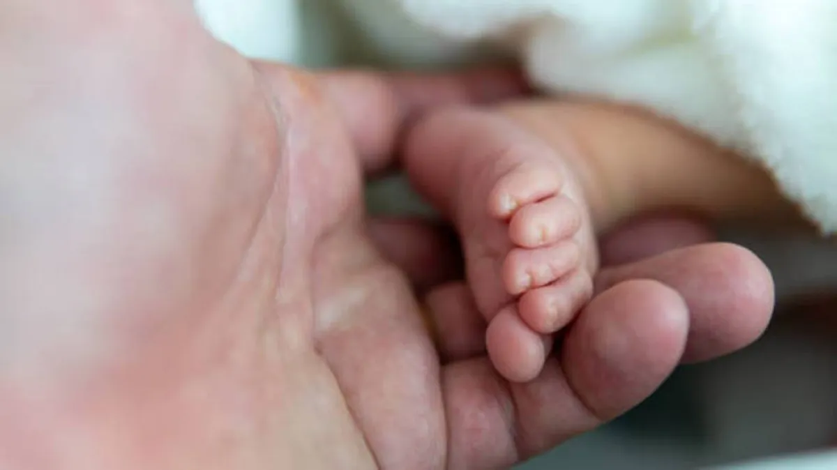 صورة لأطراف المولود