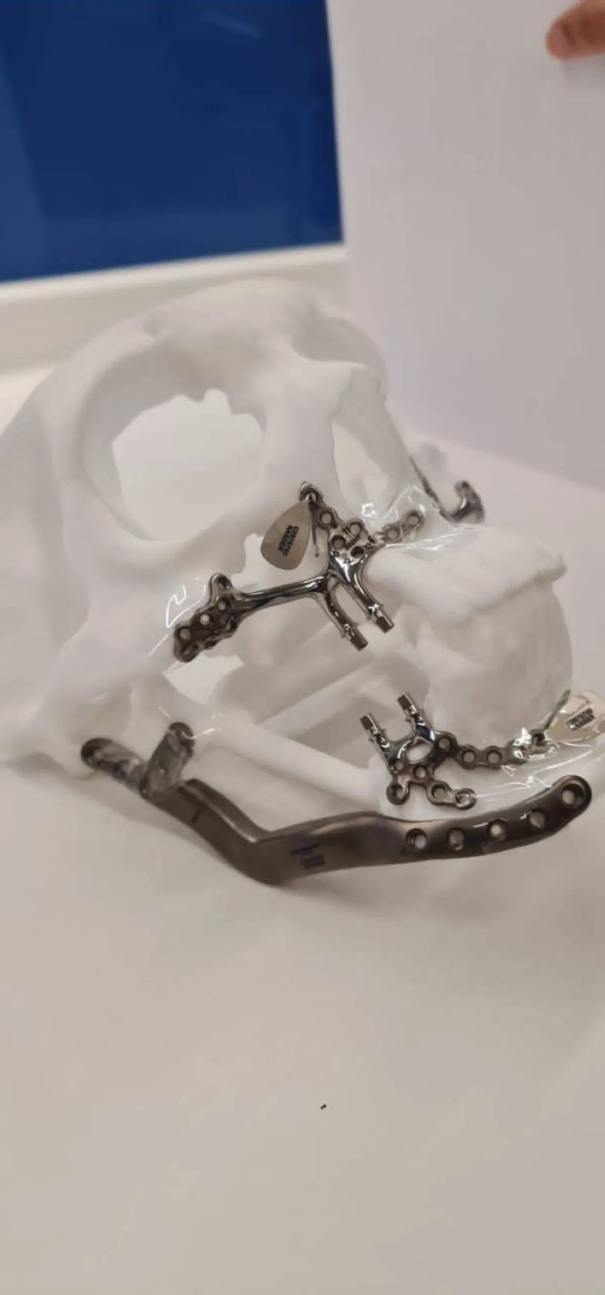 نموذج لطباعة الوجه - الصورة من الرؤية