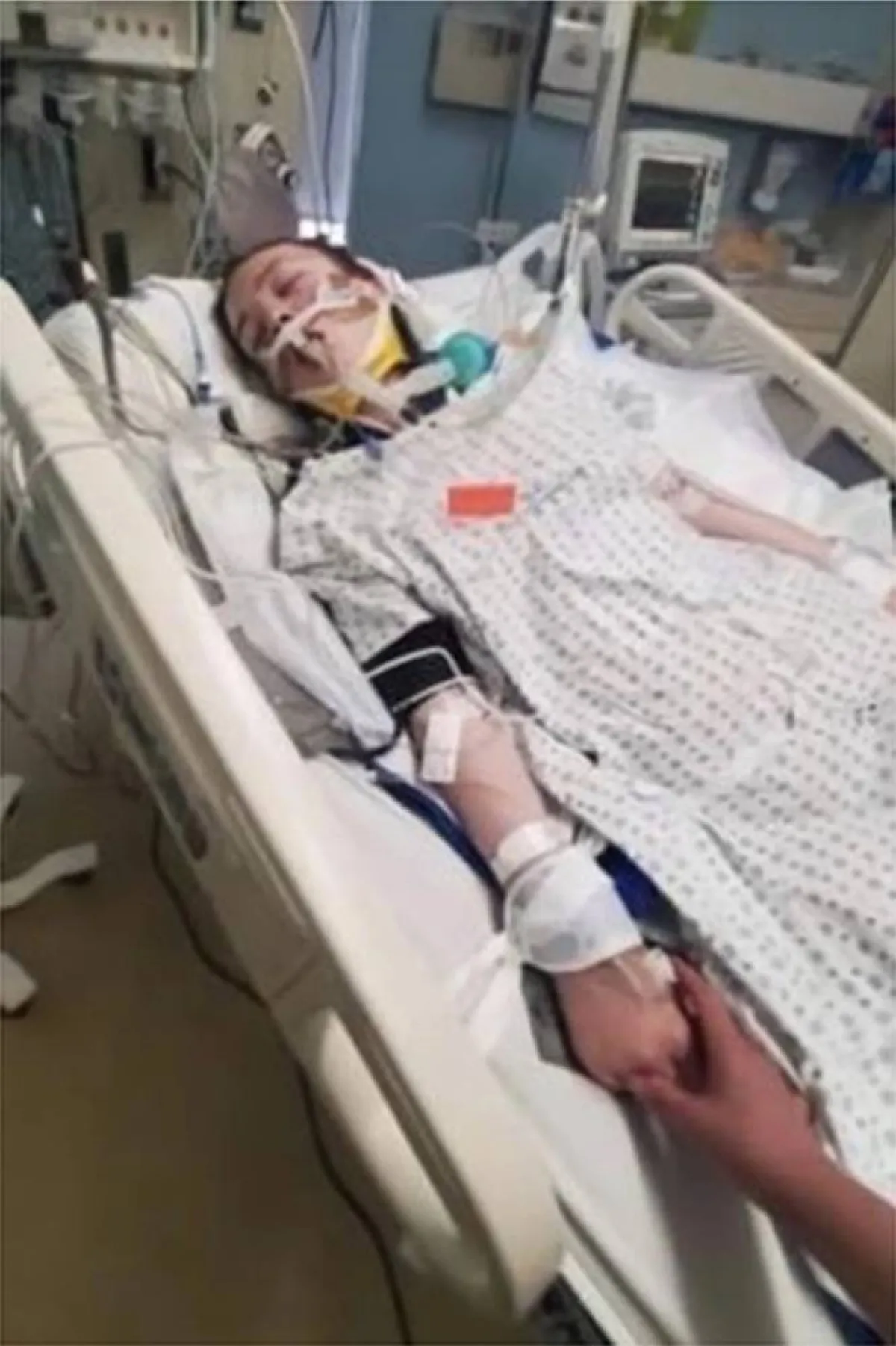 بري دوفال وقت دخولها في غيبوبة