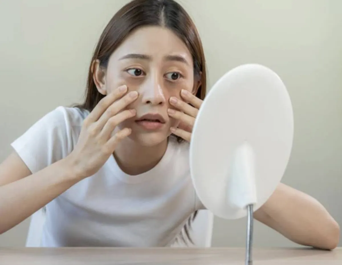 هالات العين