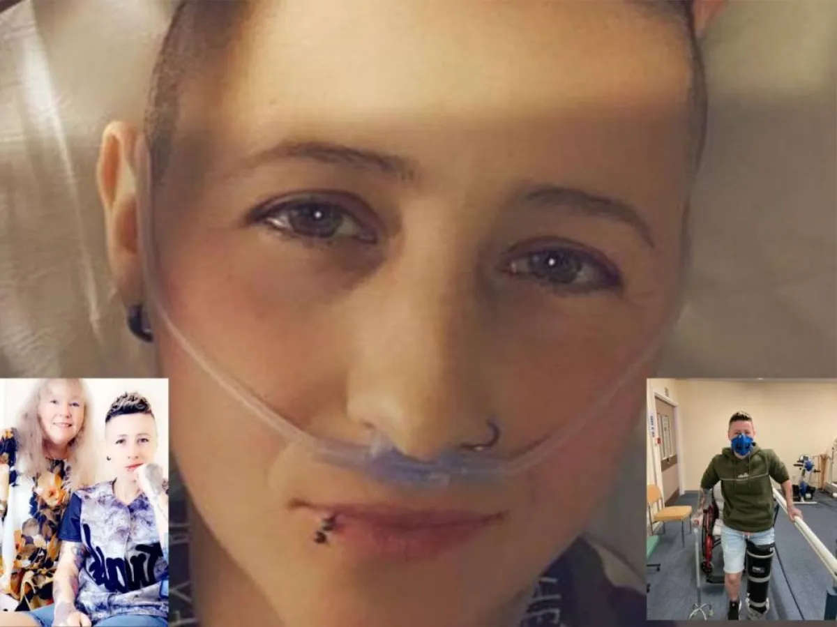 ريبيكا تشعر بأنها أفضل بعد البتر